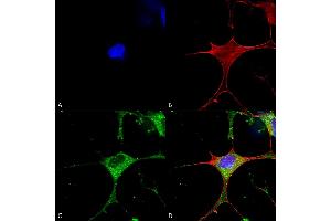 Immunocytochemistry/Immunofluorescence analysis using Mouse Anti-Clcn3 Monoclonal Antibody, Clone S258-5 (ABIN2485471).