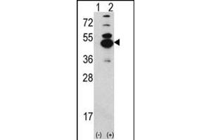 Western blot analysis of CK1D (arrow) using rabbit polyclonal CK1D Antibody (N-term) (ABIN391308 and ABIN2841343). (CAMK1D anticorps  (N-Term))