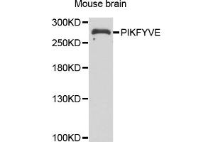 Western blot analysis of extracts of mouse brain, using PIKFYVE antibody (ABIN5974035) at 1/1000 dilution. (PIKFYVE anticorps)