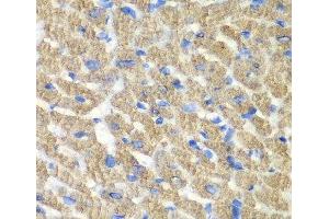 Immunohistochemistry of paraffin-embedded Mouse heart using FIBP Polyclonal Antibody at dilution of 1:100 (40x lens).