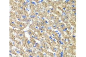 Immunohistochemistry of paraffin-embedded Mouse heart using FIBP Polyclonal Antibody at dilution of 1:100 (40x lens). (FIBP anticorps)