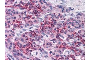 Human Pancreas: Formalin-Fixed, Paraffin-Embedded (FFPE) (XIAP anticorps  (AA 75-226))