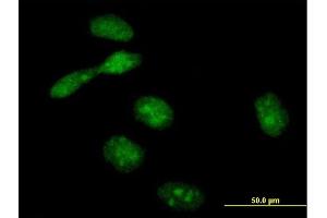 Immunofluorescence of purified MaxPab antibody to EME1 on HeLa cell. (Crossover junction endonuclease EME1 (EME1) (AA 1-583) anticorps)