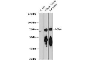 Western blot analysis of extracts of various cell lines, using NTN4 antibody (ABIN6128371, ABIN6144901, ABIN6144902 and ABIN6217888) at 1:3000 dilution.
