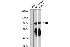 Western blot analysis of extracts of various cell lines, using NTN4 antibody (ABIN6128371, ABIN6144901, ABIN6144902 and ABIN6217888) at 1:3000 dilution. (Netrin 4 anticorps  (AA 290-520))