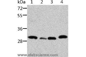 Western blot analysis of Mouse pancreas and spleen tissue, mouse heart tissue and 293T cell, using STRADB Polyclonal Antibody at dilution of 1:500