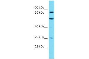 Host: Rabbit Target Name: MTMR7 Sample Type: HT1080 Whole Cell lysates Antibody Dilution: 1. (MTMR7 anticorps  (C-Term))