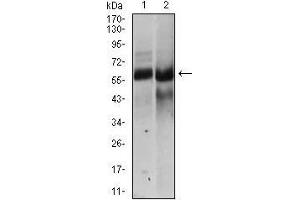 Western blot analysis using HAS2 mouse mAb against NTERA-2 (1), HEK293 (2) cell lysate. (HAS2 anticorps  (AA 67-170))