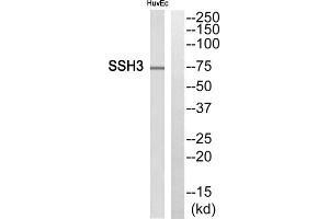 Western blot analysis of extracts from HuvEc cells, using SSH3 antibody. (SSH3 anticorps  (Internal Region))