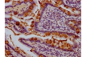 IHC image of ABIN7176254 diluted at 1:1000 and staining in paraffin-embedded human small intestine tissue performed on a Leica BondTM system.
