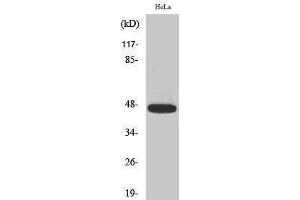 Western Blotting (WB) image for anti-Caspase 9, Apoptosis-Related Cysteine Peptidase (CASP9) (pThr125) antibody (ABIN3182484) (Caspase 9 anticorps  (pThr125))