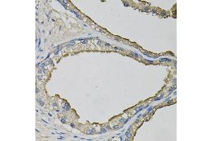 Immunohistochemistry of paraffin-embedded human prostate using LCN1 antibody. (Lipocalin 1 anticorps)