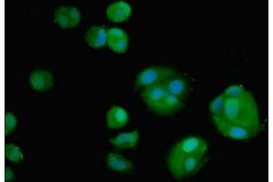 Immunofluorescent analysis of MCF-7 cells using ABIN7160302 at dilution of 1:100 and Alexa Fluor 488-congugated AffiniPure Goat Anti-Rabbit IgG(H+L)