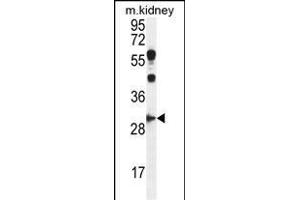 CCNG1 Antibody (C-term) (ABIN655159 and ABIN2844777) western blot analysis in mouse kidney tissue lysates (35 μg/lane). (Cyclin G1 anticorps  (C-Term))