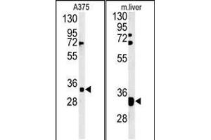(LEFT)Western blot analysis of FYTD1 Antibody (N-term) (ABIN651416 and ABIN2840226) in  cell line lysates (35 μg/lane). (FYTTD1 anticorps  (N-Term))