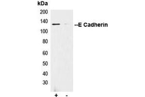 Immunoprecipitation of E Cadherin from 0.