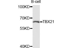 Western blot analysis of extracts of B-cell cells, using TBX21 antibody (ABIN5972689) at 1/1000 dilution. (T-Bet anticorps)
