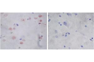 Immunohistochemistry analysis of human brain tissue slide (Paraffin embedded) using Rabbit Anti-Parkin Polyclonal Antibody (left, ABIN398785) and Purified Rabbit IgG (whole molecule) Control (right, ABIN398653) (Parkin anticorps  (AA 300-350))