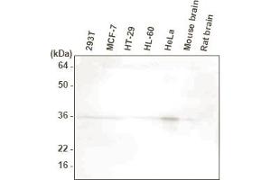 Western blot analysis. (HTRA2 anticorps  (AA 134-458))