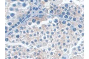 DAB staining on IHC-P; Samples: Mouse Testis Tissue (MAP4 anticorps  (AA 882-1062))