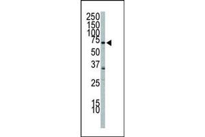 Western blot analysis of anti-PI3KR2 Pab 8024b in A549 cell lysate.