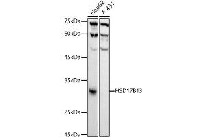 Western blot analysis of extracts of various cell lines, using HSD17B13 antibody (ABIN7267809) at 1:1000 dilution. (HSD17B13 anticorps)