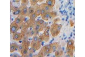Used in DAB staining on fromalin fixed paraffin-embedded Liver tissue (SHB anticorps  (AA 248-484))