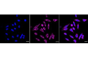 Immunocytochemical staining of HepG2 cells with HDHD5 antibody (ABIN7798836), 1:1,000). (Recombinant Haloacid Dehalogenase-Like Hydrolase Domain-Containing 5 (HDHD5) anticorps)
