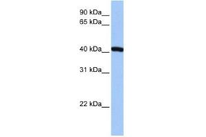 FTSJ1 antibody used at 1 ug/ml to detect target protein. (FTSJ1 anticorps)