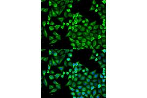 Immunofluorescence analysis of A549 cells using ABAT antibody. (ABAT anticorps)