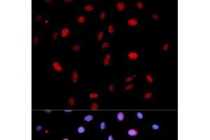 Immunofluorescence analysis of U2OS cells using Phospho-MAP2K6(S207)/MAP2K3(S189) Polyclonal Antibody (MAP2K6 anticorps  (pSer189, pSer207))