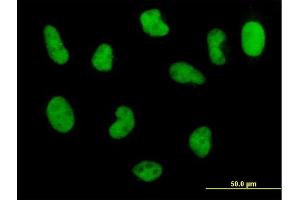 Immunofluorescence of monoclonal antibody to POLD3 on HeLa cell. (POLD3 anticorps  (AA 357-466))