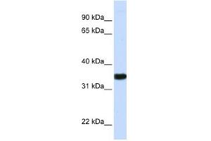 GAPDH antibody used at 1 ug/ml to detect target protein. (GAPDH anticorps  (N-Term))