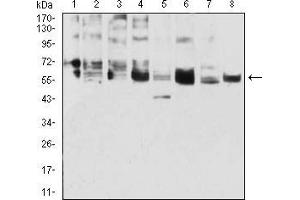 Western blot analysis using CK5 mouse mAb against A431 (1), 3T3-L1 (2), COS7 (3), MCF-7 (4), SK-Br-3 (5), Hela (6), Lncap (7), and HepG2 (8) cell lysate.