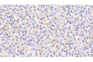 Detection of CYP2D6 in Human Liver Tissue using Polyclonal Antibody to Cytochrome P450 2D6 (CYP2D6) (CYP2D6 anticorps  (AA 236-472))