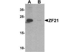 Western blot analysis of ZF21 in 3T3 cell tissue lysate with ZF21 Antibody  at 1 µg/ml in (A) the absence and (B) the presence of blocking peptide. (ZFYVE21 anticorps  (N-Term))