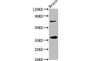 Western Blot Positive WB detected in: Rat brain tissue All lanes: EIF3I antibody at 3. (EIF3I anticorps  (AA 1-323))