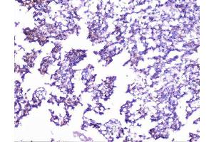 IHC analysis of cortactin using anti-cortactin antibody (ABIN6719306). (Cortactin anticorps  (AA 1-105))