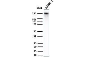 Western Blot Analysis of Human PANC-1 cell lysates using Spectrin Beta 3 Rabbit Monoclonal Antibody (SPTBN2/2979R).