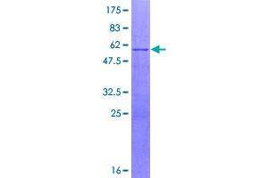 Image no. 1 for F-Box and Leucine-Rich Repeat Protein 18 (FBXL18) (AA 1-259) protein (GST tag) (ABIN1353732)