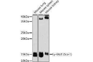 Western blot analysis of extracts of various cell lines, using Ly-6A/E (Sca-1) antibody (ABIN7268313) at 1:1000 dilution. (Sca-1/Ly-6A/E anticorps)
