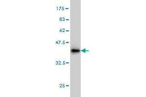 Western Blot detection against Immunogen (36. (DAZ1 anticorps  (AA 21-120))