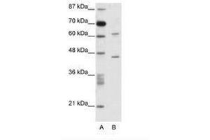 Image no. 1 for anti-TRM1 tRNA Methyltransferase 1-Like (TRMT1L) (AA 61-110) antibody (ABIN6736084) (TRMT1L anticorps  (AA 61-110))