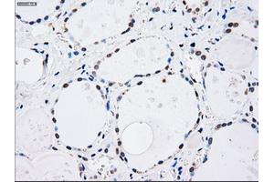 Immunohistochemical staining of paraffin-embedded lung tissue using anti-MAP2K4mouse monoclonal antibody.