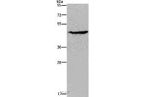 Western blot analysis of K562 cell, using ACP6 Polyclonal Antibody at dilution of 1:200 (ACP6 anticorps)