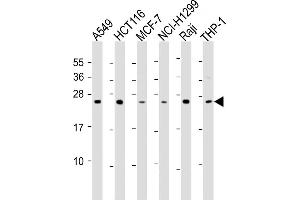 All lanes : Anti-TPD52 Antibody (C-Term) at 1:2000 dilution Lane 1: A549 whole cell lysate Lane 2: HC whole cell lysate Lane 3: MCF-7 whole cell lysate Lane 4: NCI- whole cell lysate Lane 5: Raji whole cell lysate Lane 6: THP-1 whole cell lysate Lysates/proteins at 20 μg per lane. (TPD52 anticorps  (AA 193-223))