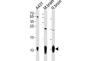 Western blot analysis of lysates from A431 cell line, mouse brain, rat brain tissue (from left to right), using S100B Antibody (ABIN651265 and ABIN2840160). (S100B anticorps)
