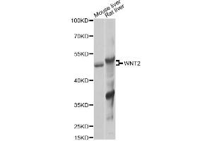 Western blot analysis of extracts of various cell lines, using WNT2 Antibody (ABIN6292350) at 1:1000 dilution. (WNT2 anticorps)