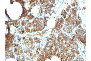 Formalin-fixed, paraffin-embedded human Parathyroid stained with PTH Mouse Monoclonal Antibody (PTH/1173). (PTH anticorps  (AA 32-115))