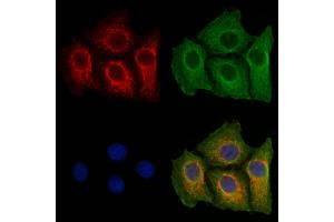 ABIN6257664 and ABIN6273422 staining Hela cells by IF/ICC. (ADCY2 anticorps  (Internal Region))
